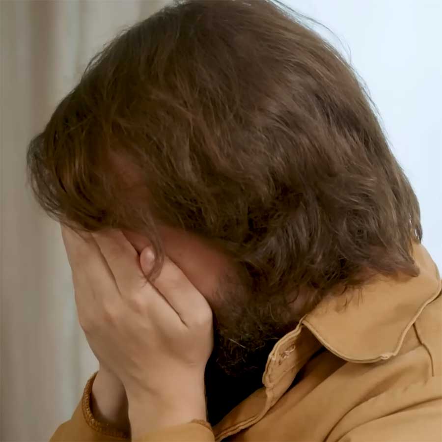 Akuter Fall von Anime-Augen